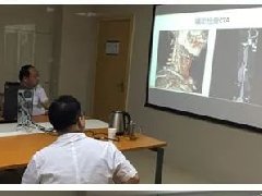 开启新模式下的颈动脉狭窄诊疗--多学科联合诊疗（MDT）