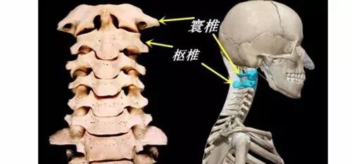孩子脖子突然歪了，家长注意！不止是落枕这么简单......