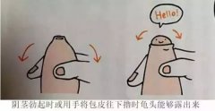 今夏最流行！“割包皮潮”又来到，这一刀，挨还是不挨？