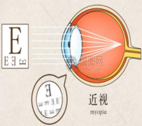 爱眼护眼  预防近视