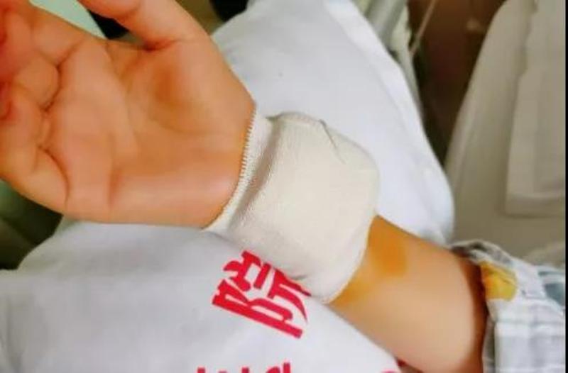 手腕上就能做的脑血管造影，微创、快速、准确，即做即走！